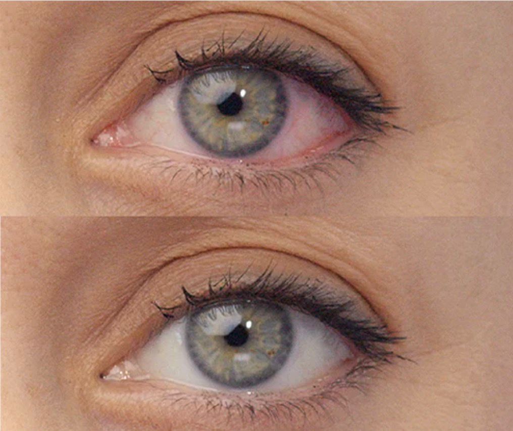 Lumify 3